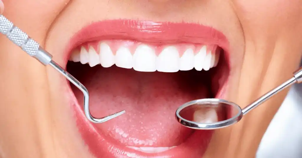 هل التامين الشامل يشمل الاسنان؟